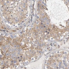 Immunohistochemical staining of human testis shows moderate membranous positivity in cells in seminiferous ducts.