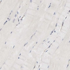 Immunohistochemical staining of human skeletal muscle shows no positivity in myocytes as expected.