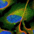 Immunofluorescent staining of human cell line U-2 OS shows localization to plasma membrane & cytosol.