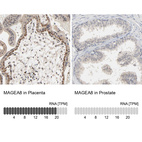 Anti-MAGEA8 Antibody