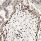 Immunohistochemical staining of human placenta shows strong nuclear positivity in trophoblastic cells.