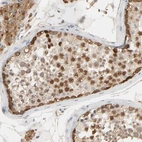 Immunohistochemical staining of human testis shows strong nuclear positivity in cells in seminiferous ducts.