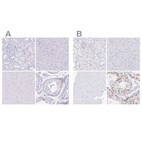 Anti-CXorf67 Antibody