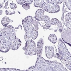 Immunohistochemical staining of human placenta shows weak nuclear positivity in trophoblastic cells.