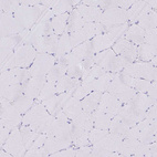 Immunohistochemical staining of human skeletal muscle shows no positivity in myocytes as expected.