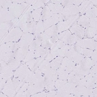 Immunohistochemical staining of human skeletal muscle shows no positivity in myocytes as expected.