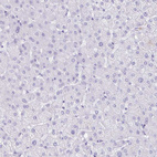 Immunohistochemical staining of human liver shows no positivity in hepatocytes as expected.