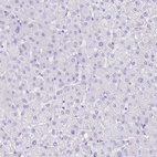 Anti-CXorf67 Antibody