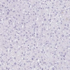 Immunohistochemical staining of human liver shows no positivity in hepatocytes as expected.