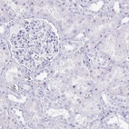 Immunohistochemical staining of human kidney shows no positivity in cells in tubules as expected.