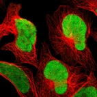 Immunofluorescent staining of human cell line U-2 OS shows localization to nucleoplasm.
