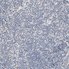 Immunohistochemical staining of human tonsil shows no positivity in non-germinal center cells as expected.