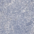 Immunohistochemical staining of human tonsil shows no positivity in non-germinal center cells as expected.