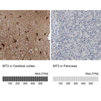 Immunohistochemistry analysis in human cerebral cortex and pancreas tissues using HPA004011 antibody. Corresponding MT3 RNA-seq data are presented for the same tissues.