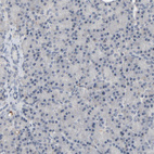 Anti-MT3 Antibody