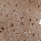 Immunohistochemical staining of human cerebral cortex shows strong cytoplasmic positivity in astrocytes.