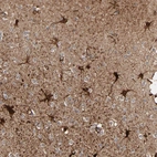 Immunohistochemical staining of human cerebral cortex shows strong cytoplasmic positivity in astrocytes.