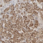 Anti-SLC30A9 Antibody