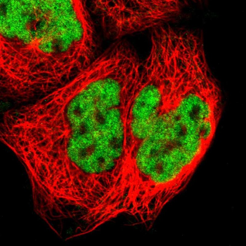 Anti-ZNF384 Antibody