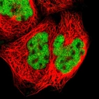 Anti-ZNF384 Antibody