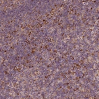Immunohistochemical staining of human lymph node shows positivity in lymphoid cells.
