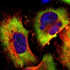 Immunofluorescent staining of human cell line U-251 MG shows localization to cytosol.