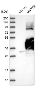Western blot analysis in control (vector only transfected HEK293T lysate) and GNPTG over-expression lysate (Co-expressed with a C-terminal myc-DDK tag (~3.1 kDa) in mammalian HEK293T cells, LY403165).