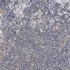 Immunohistochemical staining of human tonsil shows no cytoplasmic positivity in non-germinal center cells as expected.