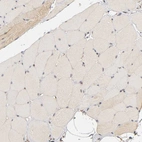 Immunohistochemical staining of human skeletal muscle shows very weak cytoplasmic positivity in myocytes.