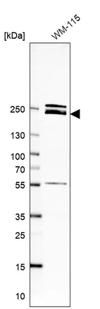 Western blot analysis in human cell line WM-115.