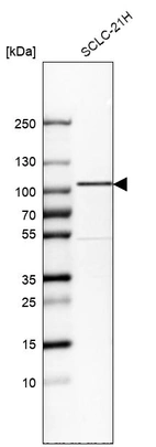 Western blot analysis in human cell line SCLC-21H.