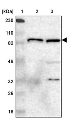 Lane 1: Marker [kDa] 230, 110, 82, 49, 32, 26, 18_br/_Lane 2: Human cell line RT-4_br/_Lane 3: Human cell line U-251MG sp