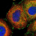 Immunofluorescent staining of human cell line A-431 shows localization to cytosol & focal adhesion sites.