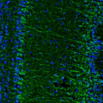 Anti-C17orf75 Antibody