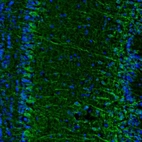 Anti-C17orf75 Antibody