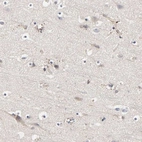 Immunohistochemical staining of human cerebral cortex shows dot like positivity in selected areas.
