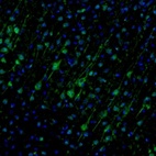 Immunofluorescence staining of mouse somatosensory cortex shows immunoreactivity in cell bodies and dendrites of pyramidal neurons.