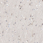 Immunohistochemical staining of human cerebral cortex shows dot-like positivity.