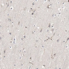 Immunohistochemical staining of human cerebral cortex shows dot-like positivity.