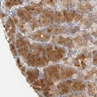 Immunohistochemical staining of human stomach shows strong cytoplasmic positivity in glandular cells.