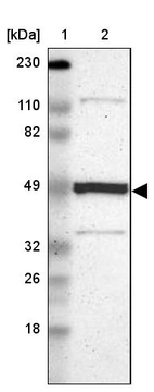 Lane 1: Marker [kDa] 230, 110, 82, 49, 32, 26, 18_br/_Lane 2: Human cell line RT-4