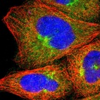 Immunofluorescent staining of human cell line A-431 shows localization to cytosol & the Golgi apparatus.