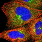 Immunofluorescent staining of human cell line A-431 shows localization to cytosol & the Golgi apparatus.