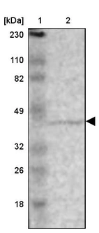 Lane 1: Marker [kDa] 230, 110, 82, 49, 32, 26, 18_br/_Lane 2: Human cell line RT-4
