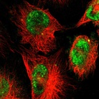 Immunofluorescent staining of human cell line U-251 MG shows localization to nucleoplasm.