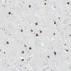 Anti-ZIC1 Antibody