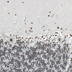 Anti-ZIC1 Antibody