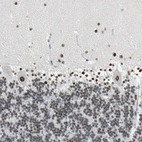 Immunohistochemical staining of human cerebellum shows strong nuclear positivity in Purkinje cells and cells in molecular and granular layer.
