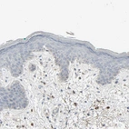 Immunohistochemical staining of human skin shows no positivity in squamous epithelial cells as expected.