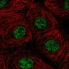 Immunofluorescent staining of human cell line MCF7 shows localization to nucleoplasm.